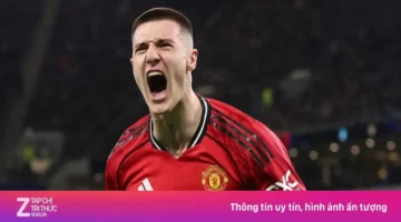 كيف يتابع الجمهور مواجهة مانشستر يونايتد وأستون فيلا عبر البث المباشر؟